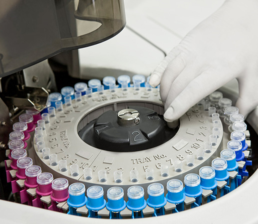 Blood Analysis Heaters for Reagent Testing